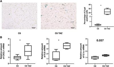 Re-Expression of Tafazzin Isoforms in TAZ-Deficient C6 Glioma Cells Restores Cardiolipin Composition but Not Proliferation Rate and Alterations in Gene Expression